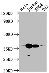 Epigentek-CDK6重組單克隆抗體[8G3]：