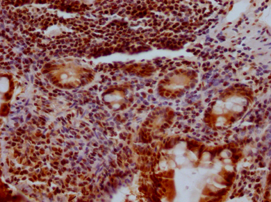 KLF4重組單克隆抗體[3A1]