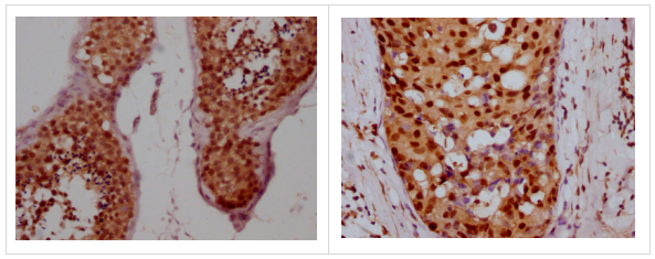 CCNE1重組單克隆抗體[3A5]