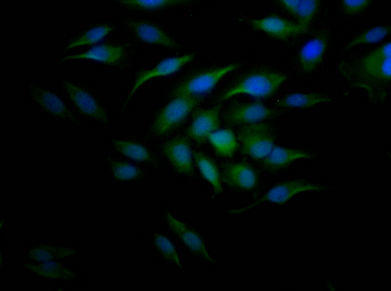 CCNE1重組單克隆抗體[9H12]