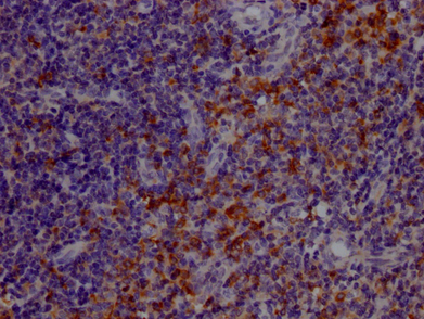 Epigentek-TLR7重組單克隆抗體[6E5] 