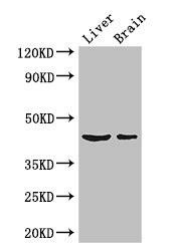METTL2A多克隆抗體