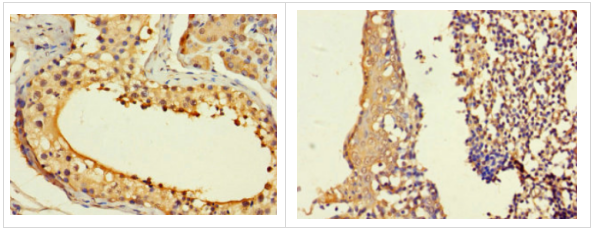 ASF1B多克隆抗體