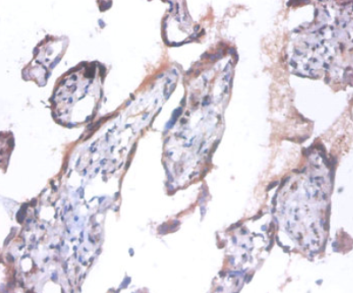 ANAPC5多克隆抗體