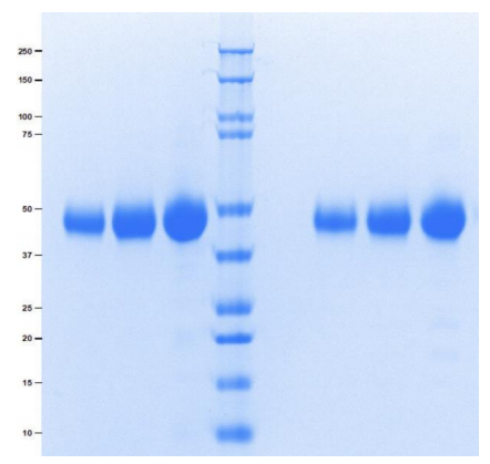 α1酸性糖蛋白 (A1AGP)
