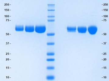 α1抗胰凝乳蛋白酶