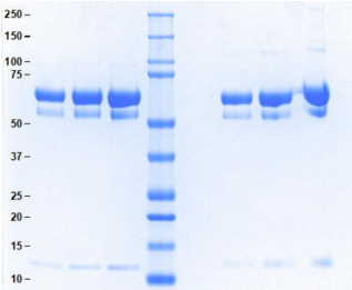 Athens-α2抗纖溶酶
