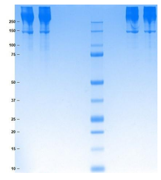 SDS-PAGE電泳條件