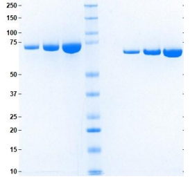無鐵轉(zhuǎn)鐵蛋白