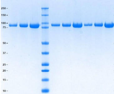 C-1酯酶抑制劑, 人血漿