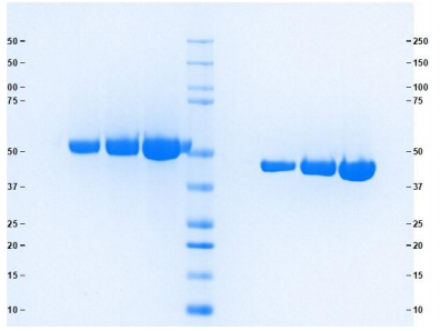 混合型GC球蛋白