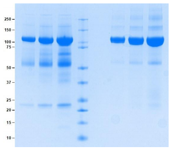 高分子量激肽原
