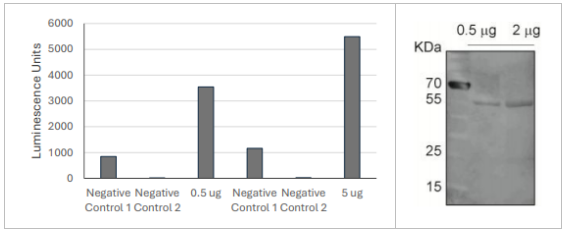 泛素C端水解酶L5多克隆抗體（抗UCH-L5抗體）