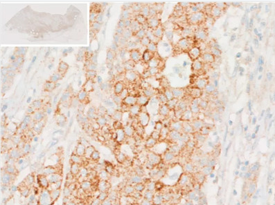 L-犬尿氨酸抗體-小鼠單克隆抗體（mAb）