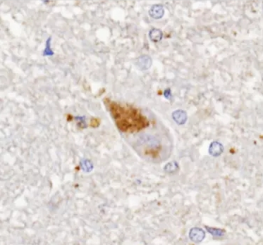 喹啉甲酸抗體-小鼠單克隆抗體（mAb）