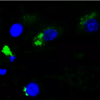 人中腦中黃尿酸的免疫熒光檢測