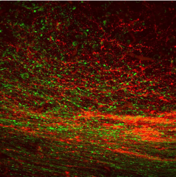 5-羥色胺（血清素）抗體-小鼠單克隆抗體（mAb）