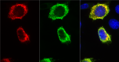 FluoTag-X4抗RFP AbberiorStar635P