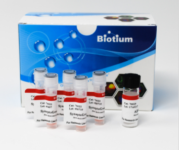 神經(jīng)末梢染色試劑盒標準化試劑盒