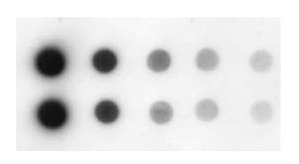 檢測(cè)轉(zhuǎn)鐵蛋白