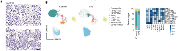 LiMacs有助于微生物刺激條件下中性粒細(xì)胞的募集