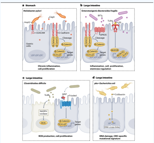 乳腺癌和前列腺癌的微生物群腫瘤相關(guān)特征