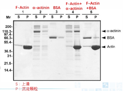 Actin結(jié)合蛋白分析試劑盒.jpg