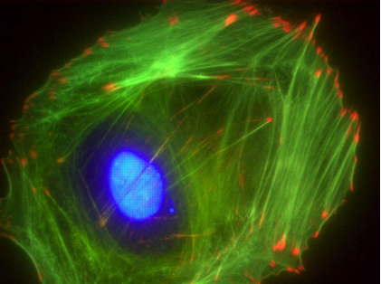 Swiss 3T3細(xì)胞anti-vinculin(紅色).png