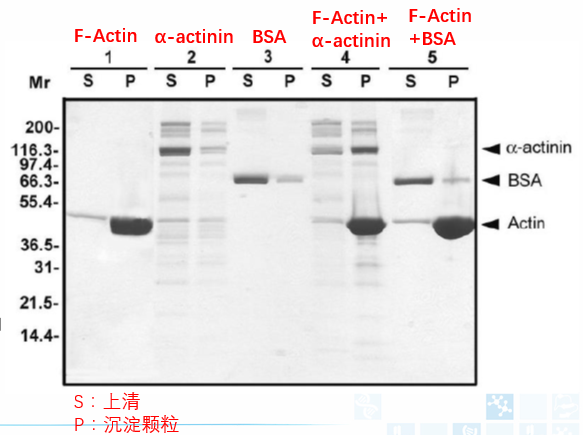 Actin結(jié)合蛋白分析試劑盒
