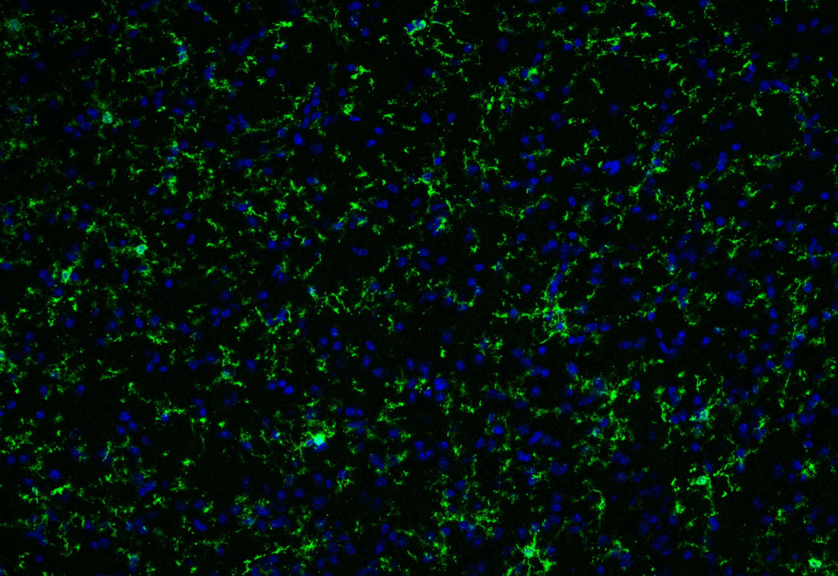 小鼠抗P2Y12抗體