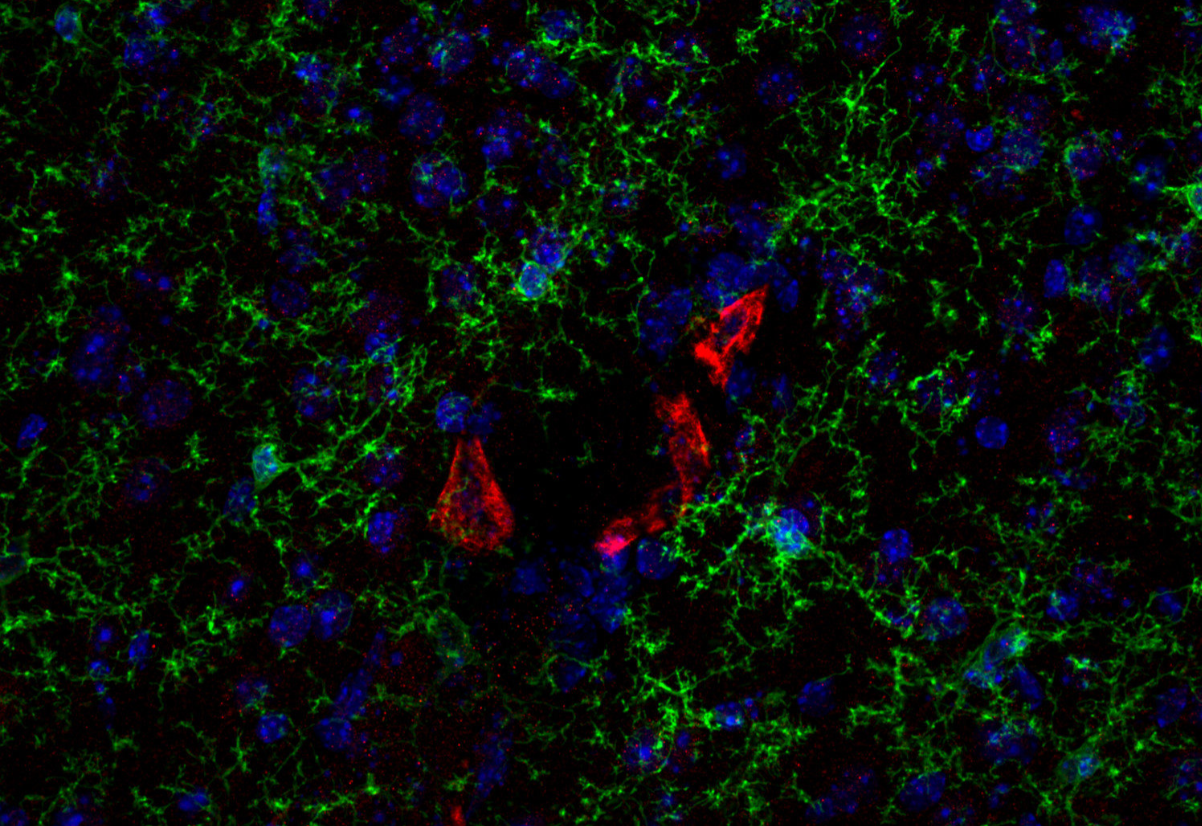 小鼠抗P2Y12抗體