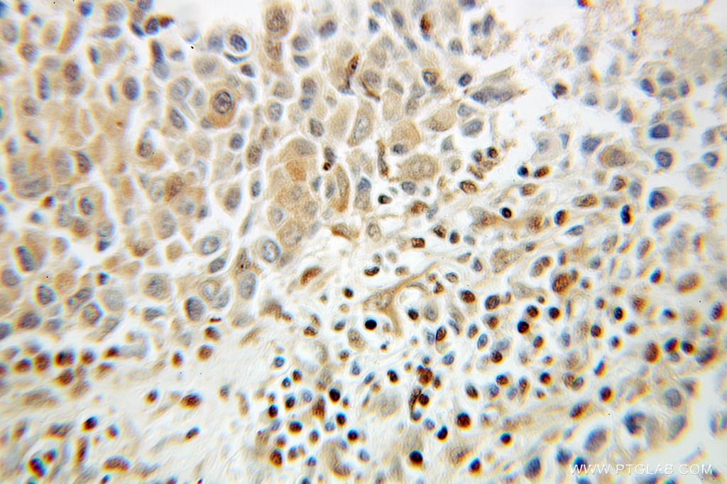 ProteinTech GAPDH單抗在IHC中的表現(xiàn)